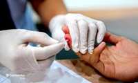 آموزش  و غربالگری HIV   دانشجویان شرق تهران